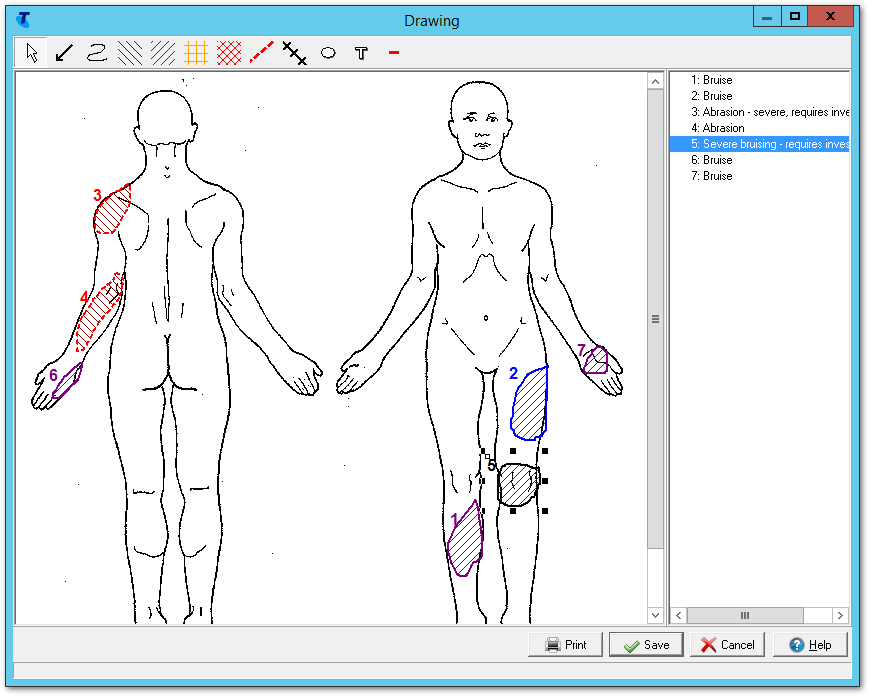 Example Drawing clinical image